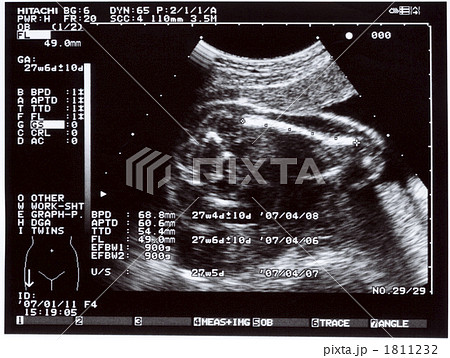 胎児 腹部エコー エコー エコー検査の写真素材
