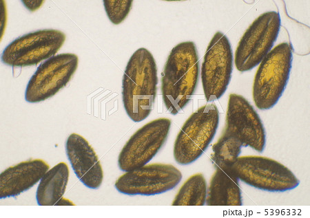 花粉 ミクロ 顕微鏡写真 ユリの花粉の写真素材