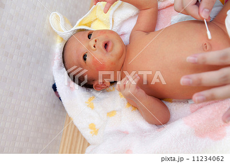臍処置 乳児の写真素材