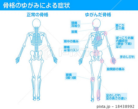 O脚矯正のイラスト素材