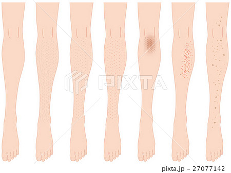 ベクター 脚 足 黒ずみのイラスト素材