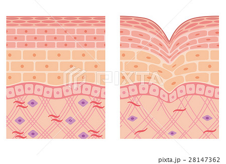 皮膚のイラスト素材