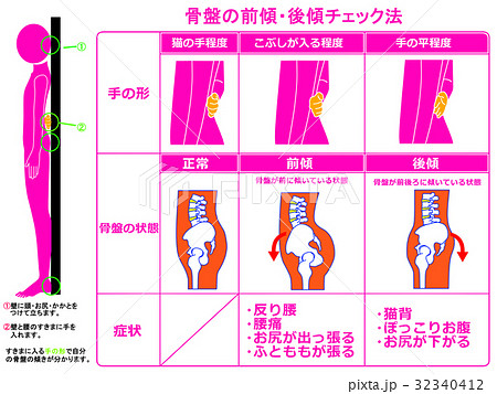 骨盤矯正のイラスト素材