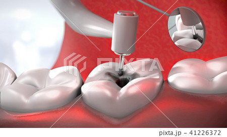 歯 ドリル 歯医者 歯科医のイラスト素材