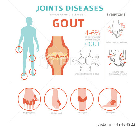痛風のイラスト素材