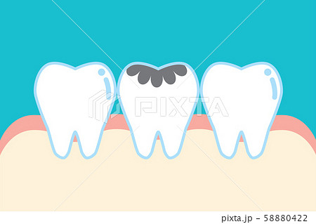 虫歯のイラスト素材集 ピクスタ