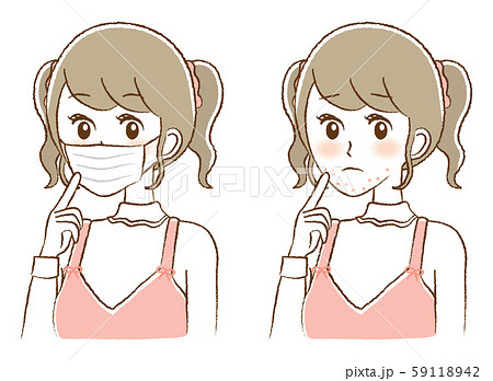 ニキビ 女性 顎 毛穴のイラスト素材