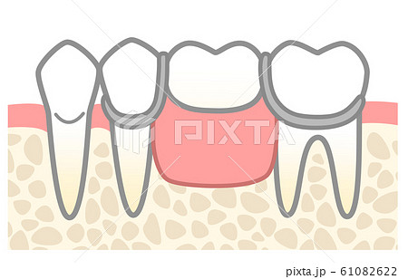 入れ歯のイラスト素材集 ピクスタ