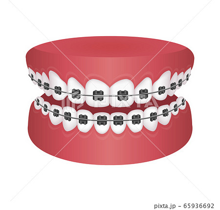 歯列のイラスト素材