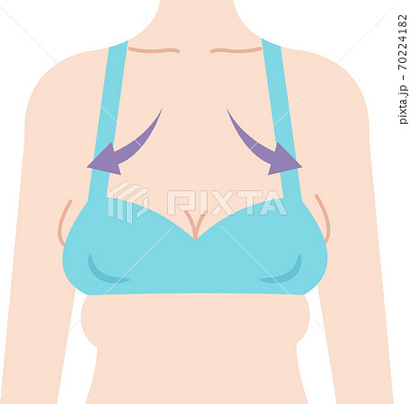 Bust foundation garment before and after - Stock Illustration [76771009] -  PIXTA