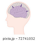 前頭側頭型認知症の脳のイラスト 前頭葉と側頭葉の萎縮のイラスト素材