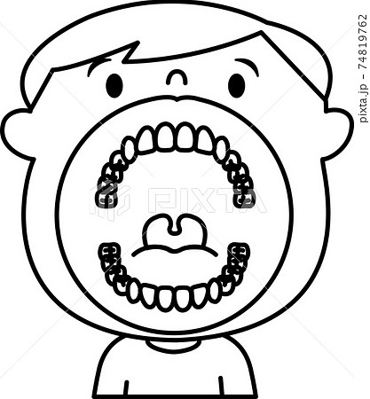 小臼歯のイラスト素材