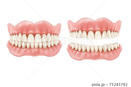 虫歯治療のイラスト素材