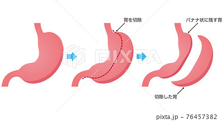 胃のイラスト素材