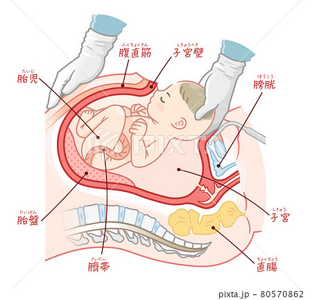 妊娠 出産のイラスト素材集 ピクスタ